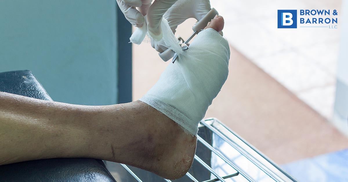 10 Things You Might Not Have Know About Diabetic Foot Ulcers